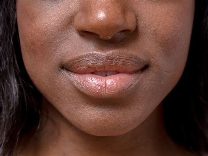 How can I turn my black lips red?