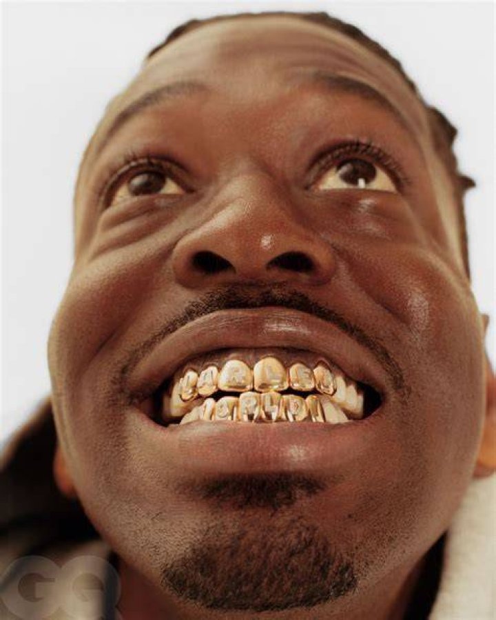 How did people get gold teeth?
