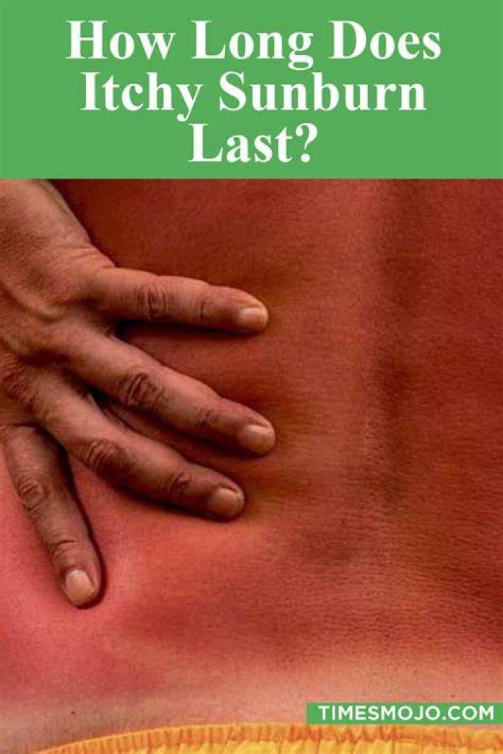 How long does Itchy last?